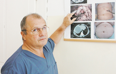 Chirugul Dan Sabău a inventat  un dispozitiv pentru aspiraţia chisturilor