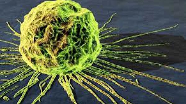 Cancerul agresiv ar putea fi distrus după un tratament de doar o zi