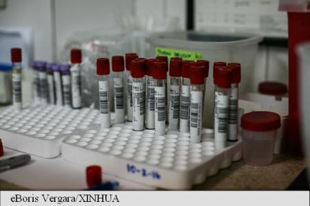 VIRUSUL ZIKA O femeie din Coreea de Sud a contractat infecție cu virusul Zika in Vietnam