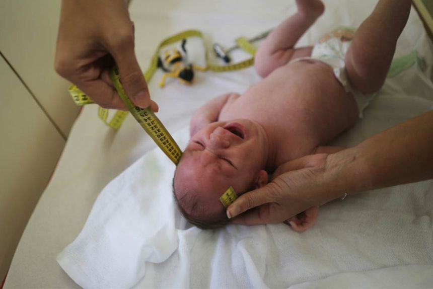 S-a nascut primul copil cu microcefalie din cauza Zika