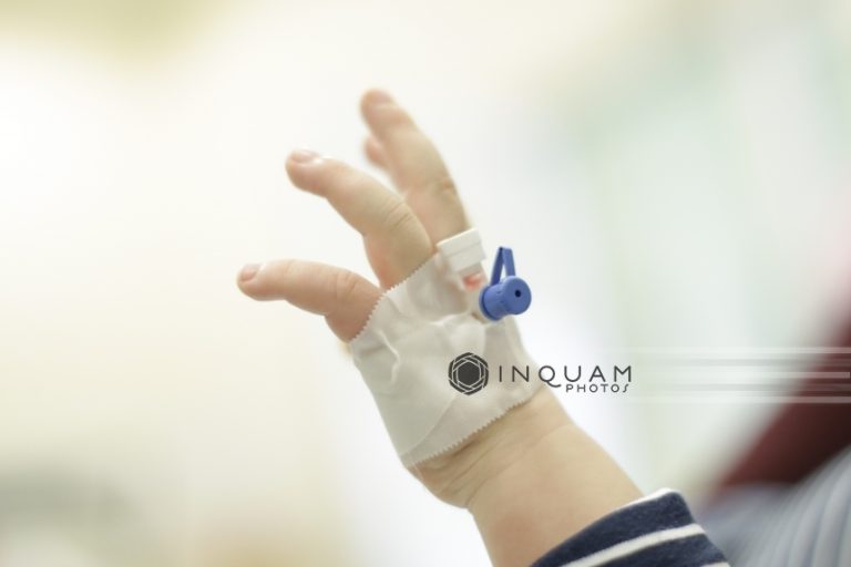 Un bebeluş de cinci luni a murit de rujeolă