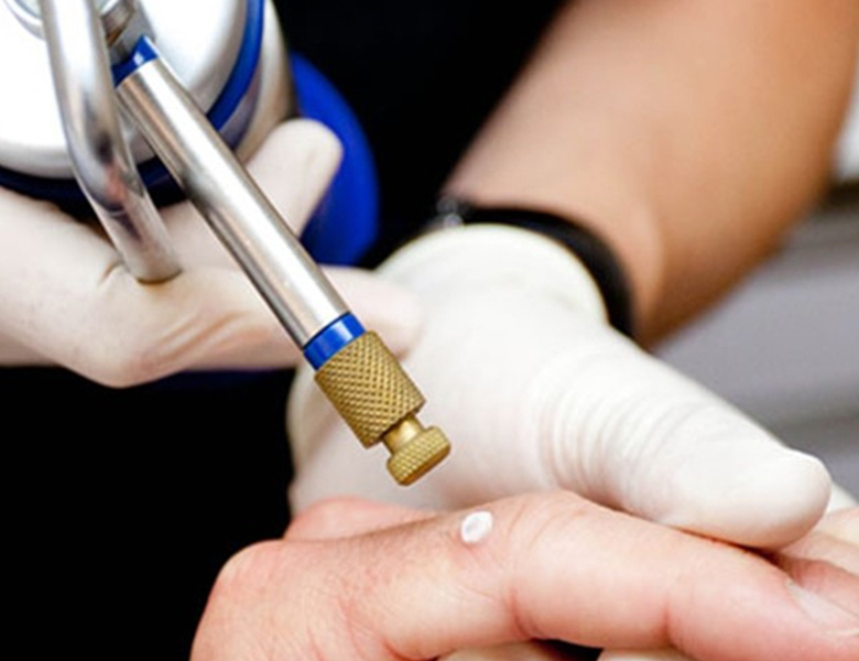 Clinica Medicala Misan Med-Dr. Andreea Csillag despre Crioterapia