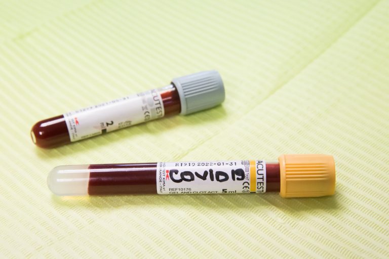 Ministerul Educaţiei: În ultima săptămână s-a înregistrat o scădere a numărului de infectări cu SARS-CoV-2 în mediul şcolar