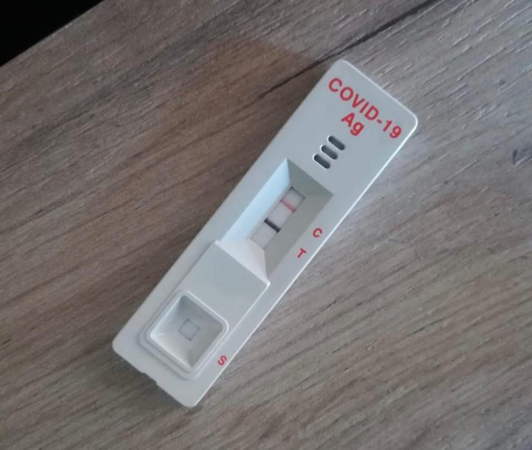 Ministerul Sănătății modifică legea privind testele antigen. Cine le va putea utiliza