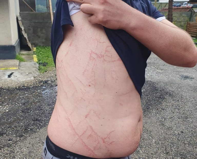 FOTO SALVAMONT: Cum arată corpul unui bărbat după ce a fost atins de trăsnet pe un munte. Recomandări utile