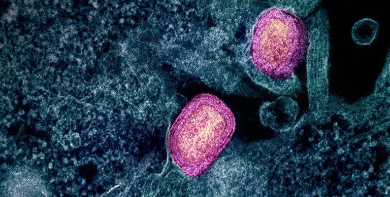 Primul caz al unei noi forme de mpox, confirmat în Statele Unite