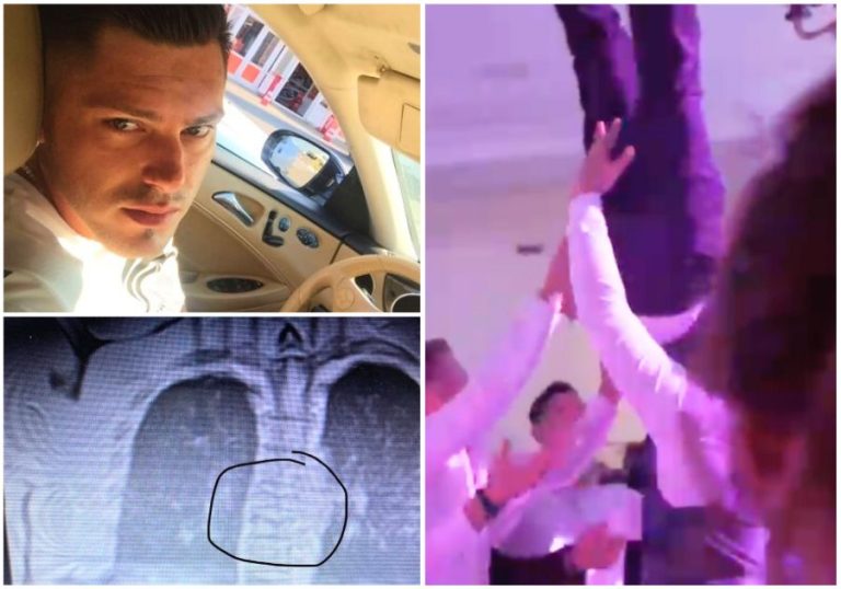 Un mire, rănit grav la propria nuntă după ce a fost scăpat din brațe 4 prieteni, a obținut daune de 20.000 de euro