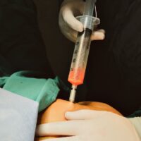 „Grăsime de la cadavre”, noul trend în estetică. Cum profită industria frumuseții de boom-ul Ozempic