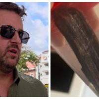 Pacient din Satu Mare, trimis acasă cu așchii de lemn în obraz. Bărbatul a ajuns în stare gravă la un alt spital
