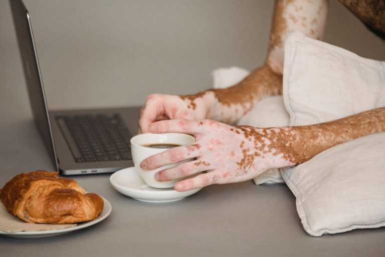 Descoperire științifică: Pastila zilnică ce ar putea reda pigmentul pielii în vitiligo