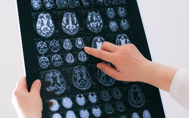Ziua Mondială a AVC: simptomele care impun apelul la 112